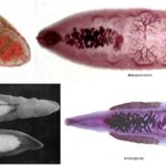 Types of flukes