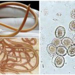 Roundworm e le loro uova